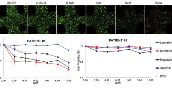 我国科学家报道全球首个3D打印原代肝细胞癌个体化药筛模型